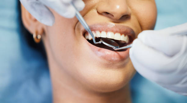 Best Emergency Tooth Extraction in Hebron, MD